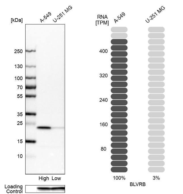 Biliverdin Reductase B/BLVRB Antibody - BSA Free Western Blot: Biliverdin Reductase B/BLVRB Antibody - BSA Free [NBP1-83435]