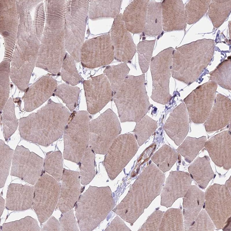 HDAC5 Antibody - BSA Free Immunohistochemistry-Paraffin: HDAC5 Antibody [NBP1-83436]