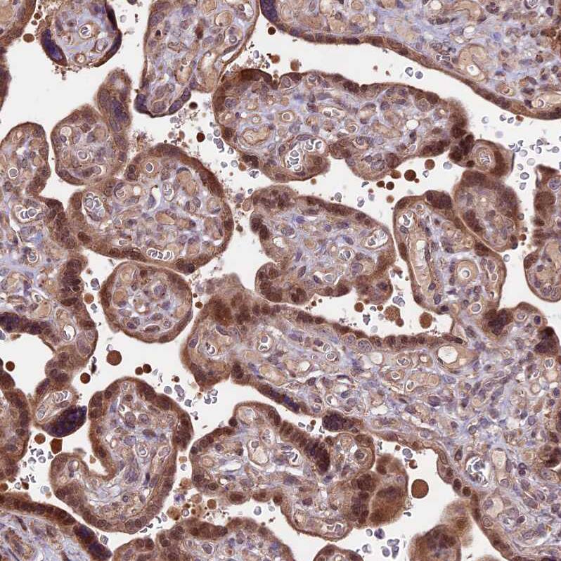 HDAC5 Antibody - BSA Free Immunohistochemistry-Paraffin: HDAC5 Antibody [NBP1-83436]