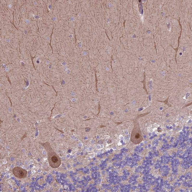 HDAC5 Antibody - BSA Free Immunohistochemistry-Paraffin: HDAC5 Antibody [NBP1-83436]