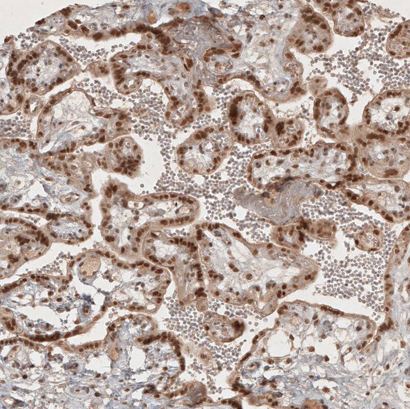 RECQL5 Antibody - BSA Free Immunohistochemistry-Paraffin: RECQL5 Antibody - BSA Free [NBP1-83438]