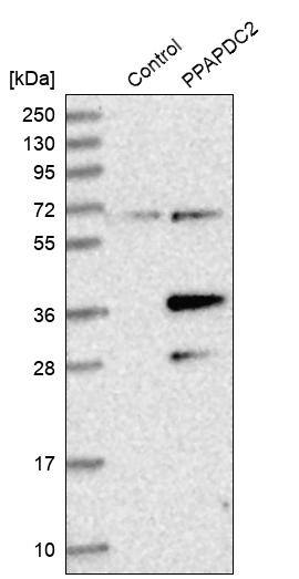 PDP1/PPAPDC2 Antibody - BSA Free Western Blot: PDP1/PPAPDC2 Antibody - BSA Free [NBP1-83443]