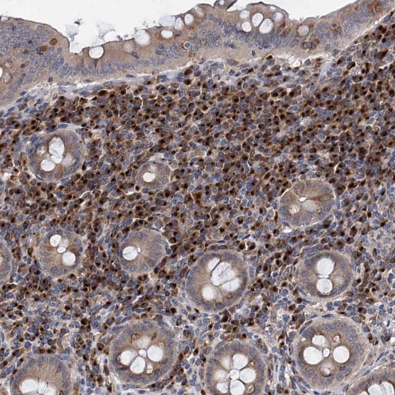 SAAL1 Antibody - BSA Free Immunohistochemistry-Paraffin: SAAL1 Antibody [NBP1-83447]