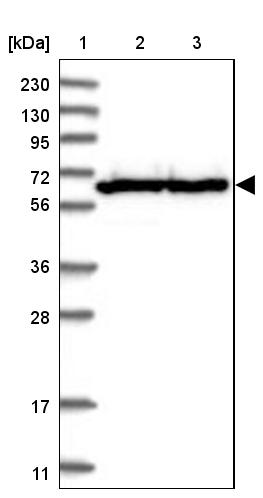 TMCO6 Antibody - BSA Free Western Blot: TMCO6 Antibody - BSA Free [NBP1-83463]