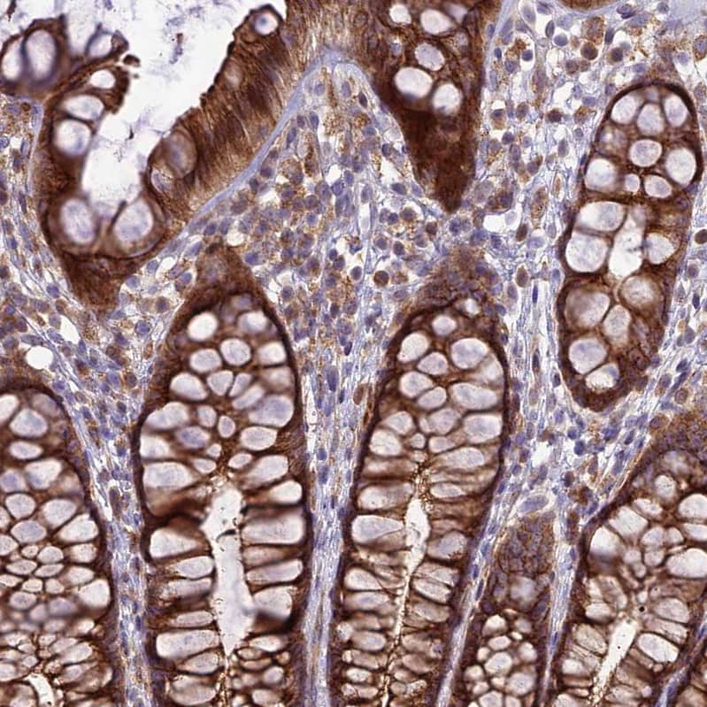 JMY Antibody - BSA Free Immunohistochemistry-Paraffin: JMY Antibody - BSA Free [NBP1-83478]