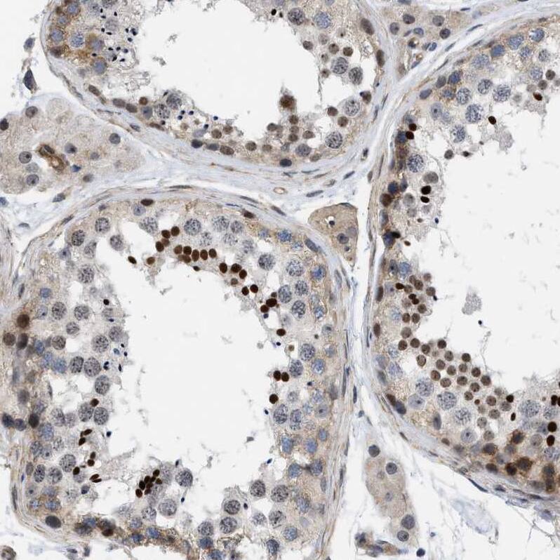 GPRASP2 Antibody - BSA Free Immunohistochemistry-Paraffin: GPRASP2 Antibody - BSA Free [NBP1-83480]