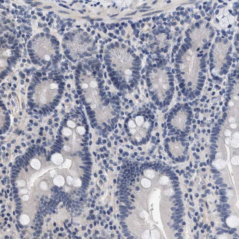 GPRASP2 Antibody - BSA Free Immunohistochemistry-Paraffin: GPRASP2 Antibody - BSA Free [NBP1-83480]