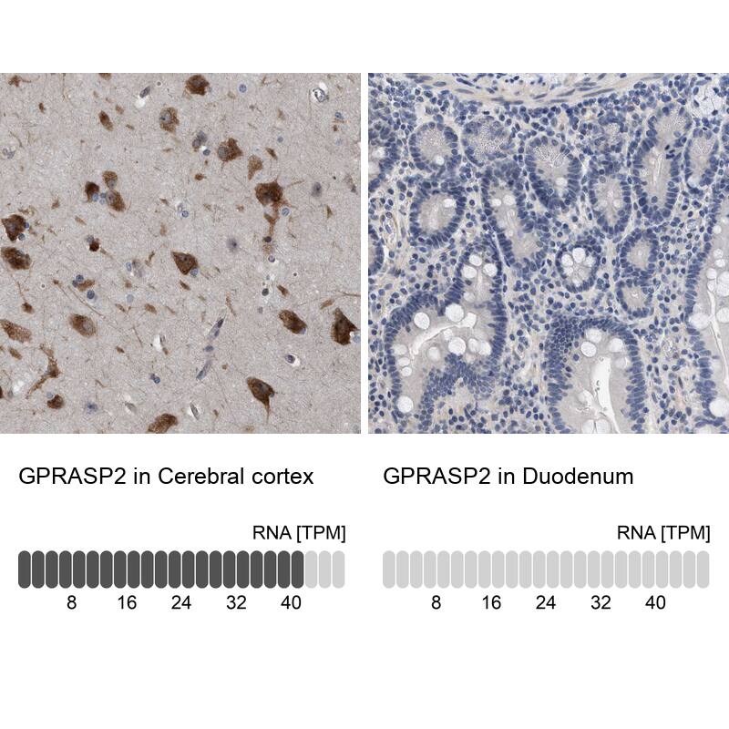 GPRASP2 Antibody - BSA Free Immunohistochemistry-Paraffin: GPRASP2 Antibody - BSA Free [NBP1-83480]