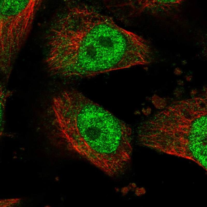 HECTD2 Antibody - BSA Free Immunocytochemistry/ Immunofluorescence: HECTD2 Antibody - BSA Free [NBP1-83481]