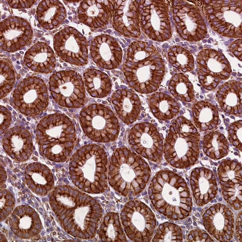 LRRC57 Antibody - BSA Free Immunohistochemistry-Paraffin: LRRC57 Antibody [NBP1-83485]