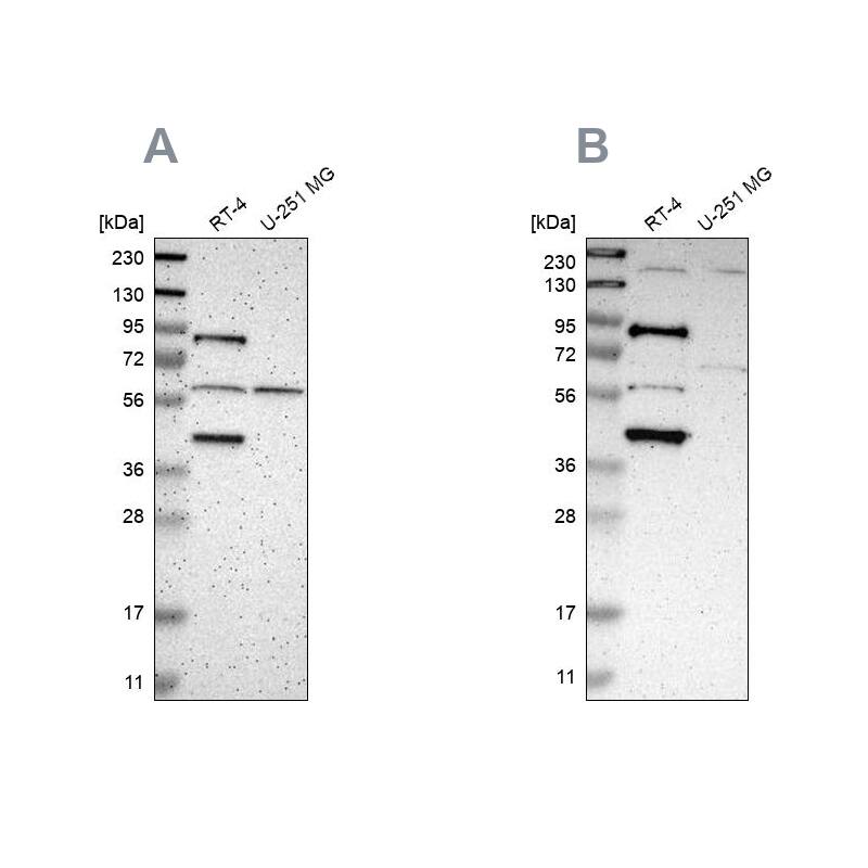 SARG Antibody Western Blot: SARG Antibody Antibody [NBP1-83487]