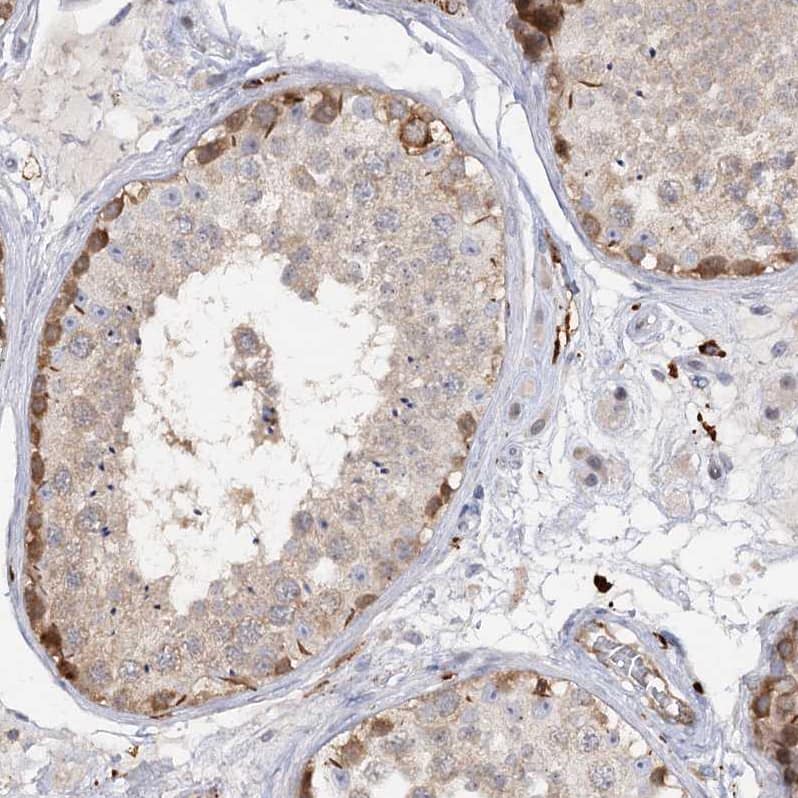 PIWIL4 Antibody - BSA Free Immunohistochemistry-Paraffin: PIWIL4 Antibody - BSA Free [NBP1-83491]