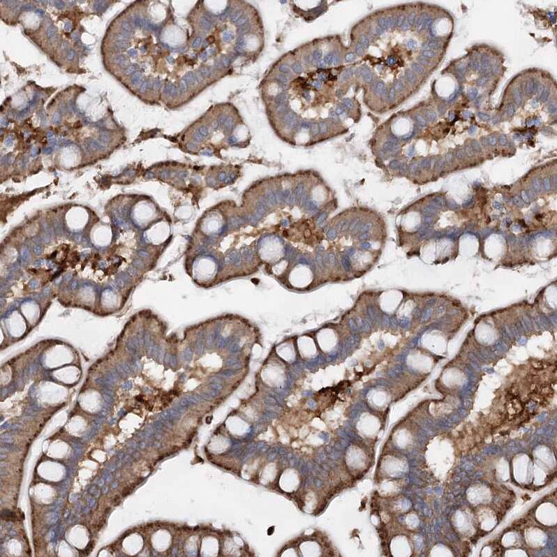 PIWIL4 Antibody - BSA Free Immunohistochemistry-Paraffin: PIWIL4 Antibody - BSA Free [NBP1-83491]
