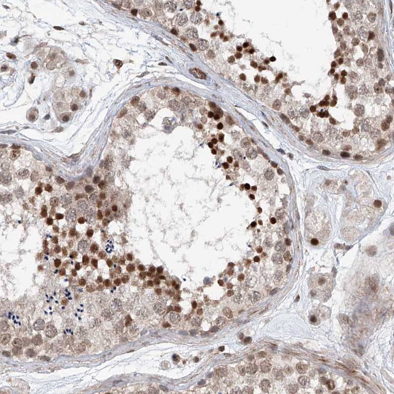 SDE2 Antibody - BSA Free Immunohistochemistry-Paraffin: SDE2 Antibody - BSA Free [NBP1-83502]