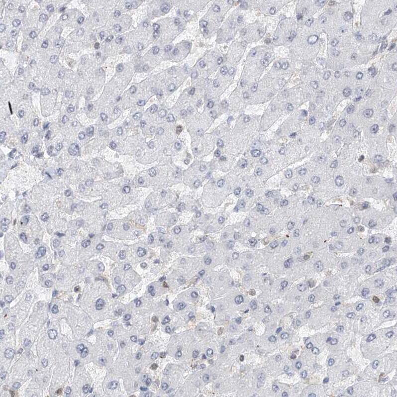 SDE2 Antibody - BSA Free Immunohistochemistry-Paraffin: SDE2 Antibody - BSA Free [NBP1-83502]