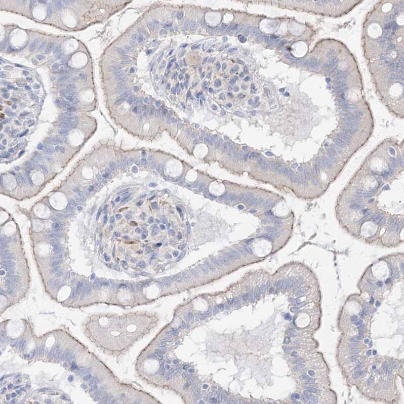 RNF175 Antibody - BSA Free Immunohistochemistry-Paraffin: RNF175 Antibody - BSA Free [NBP1-83507]