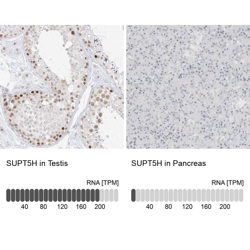 SUPT5H Antibody - BSA Free Immunohistochemistry-Paraffin: SUPT5H Antibody - BSA Free [NBP1-83508]