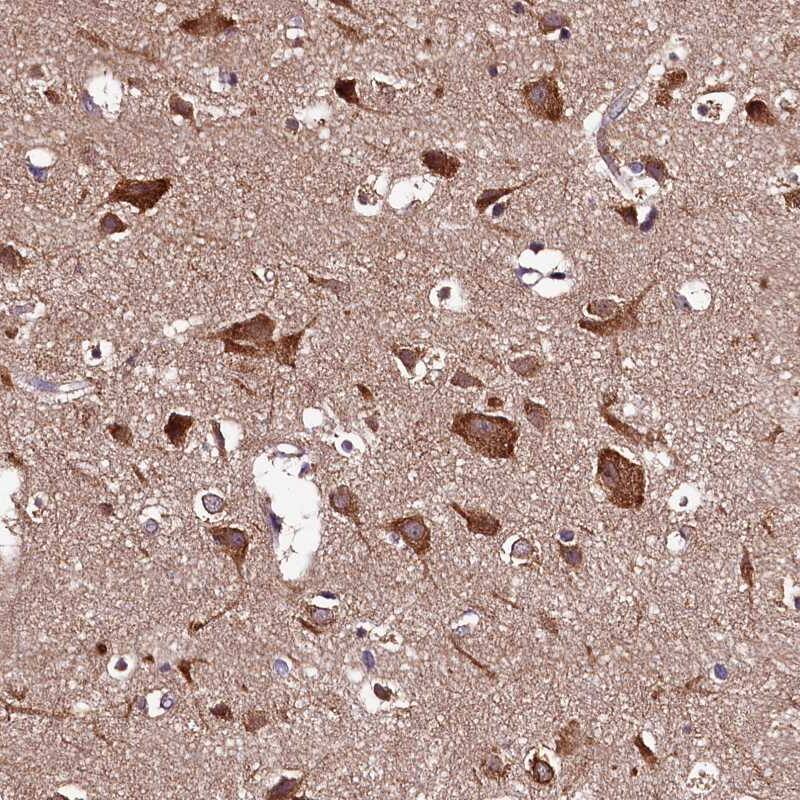 HYLS1 Antibody - BSA Free Immunohistochemistry-Paraffin: HYLS1 Antibody [NBP1-83513]