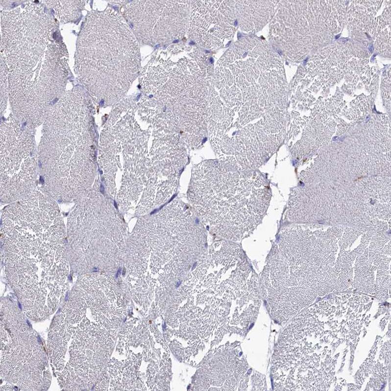PRRC1 Antibody - BSA Free Immunohistochemistry-Paraffin: PRRC1 Antibody - BSA Free [NBP1-83514]