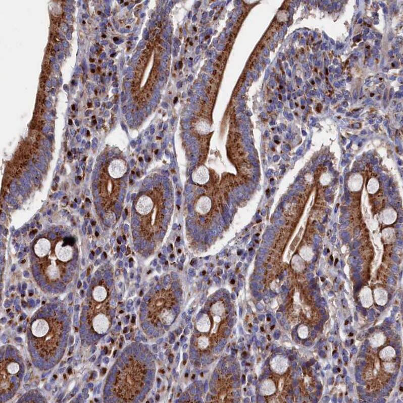 PRRC1 Antibody - BSA Free Immunohistochemistry-Paraffin: PRRC1 Antibody - BSA Free [NBP1-83514]