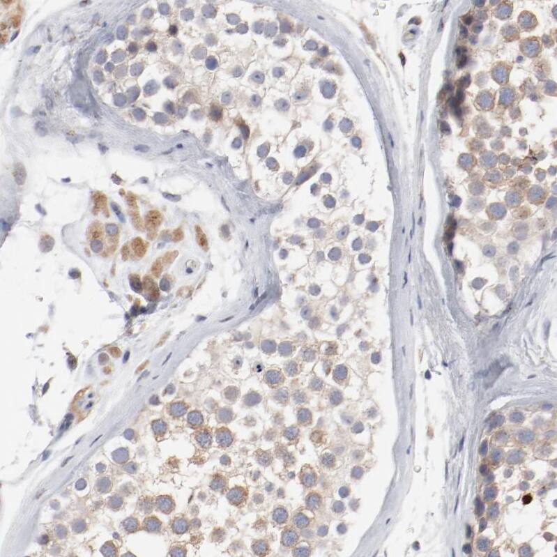 AK7 Antibody - BSA Free Immunohistochemistry-Paraffin: AK7 Antibody - BSA Free [NBP1-83515]
