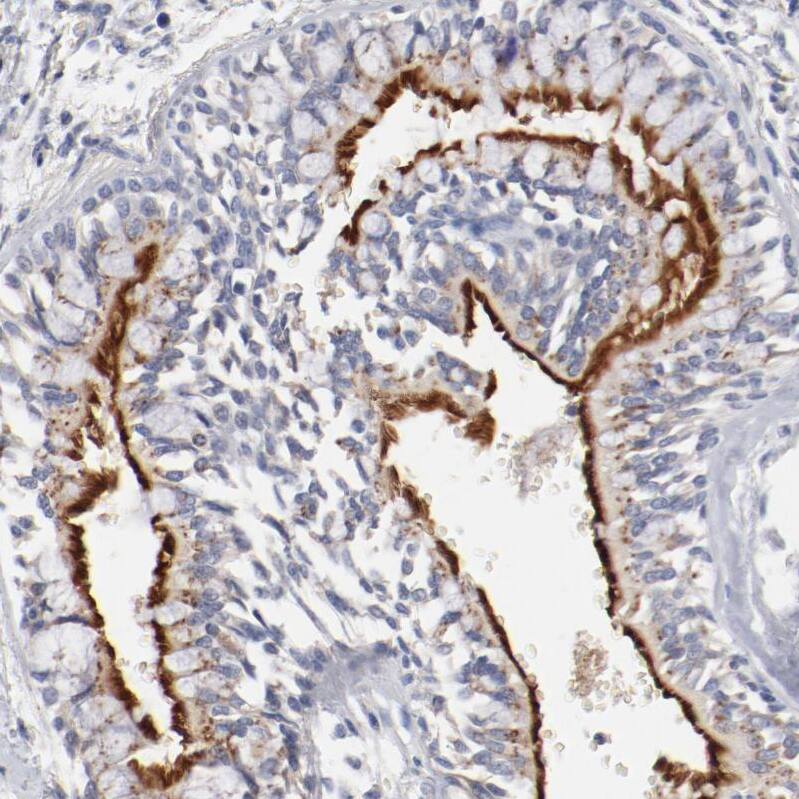AK7 Antibody - BSA Free Immunohistochemistry-Paraffin: AK7 Antibody - BSA Free [NBP1-83515]