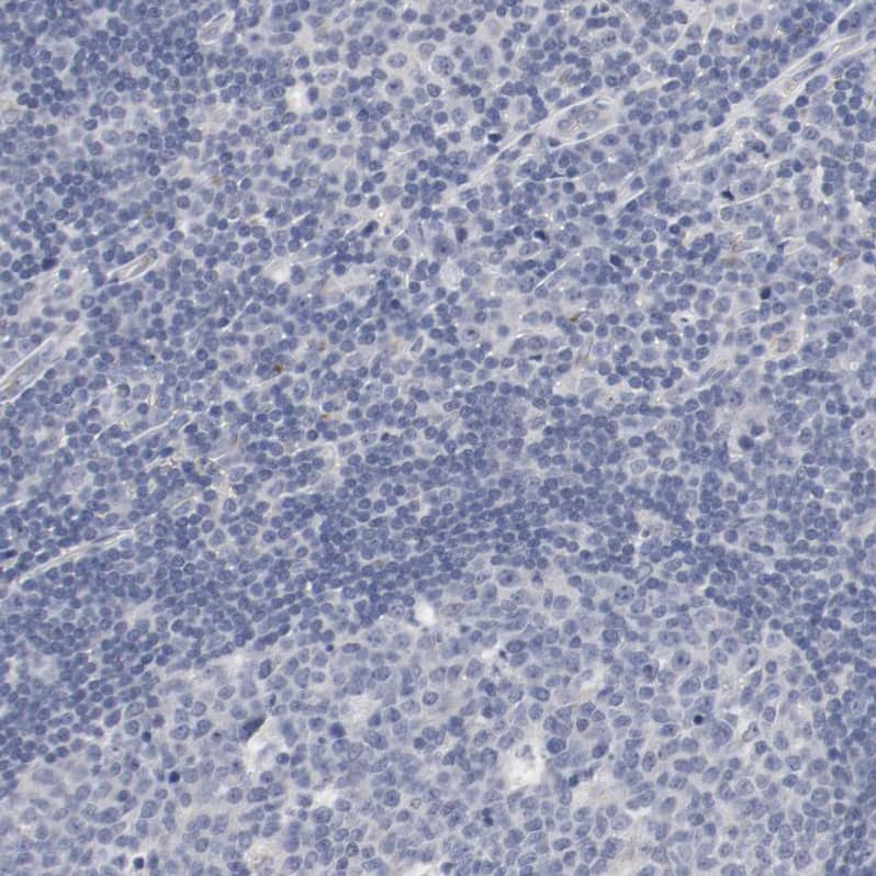 AK7 Antibody - BSA Free Immunohistochemistry-Paraffin: AK7 Antibody - BSA Free [NBP1-83515]