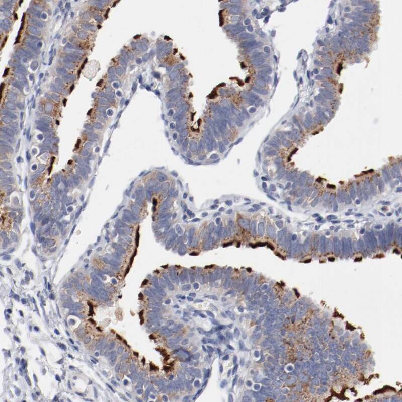 AK7 Antibody - BSA Free Immunohistochemistry-Paraffin: AK7 Antibody - BSA Free [NBP1-83515]