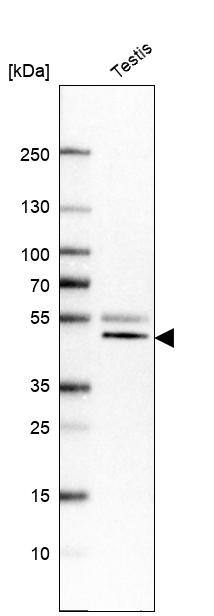 VPS37A Antibody - BSA Free Western Blot: VPS37A Antibody - BSA Free [NBP1-83528]