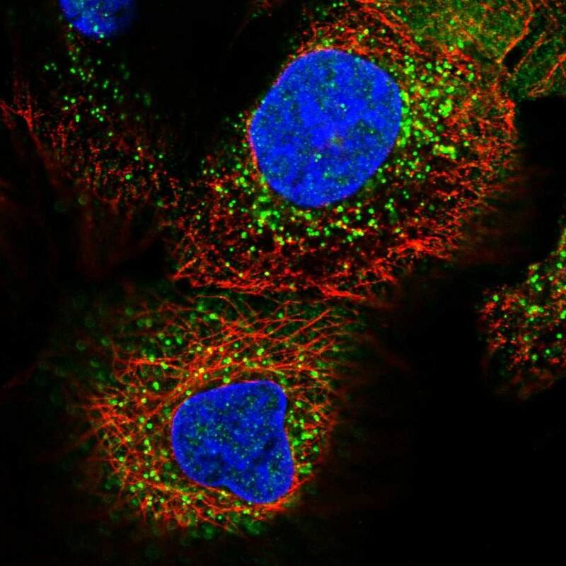 ADHFE1 Antibody - BSA Free Immunocytochemistry/ Immunofluorescence: ADHFE1 Antibody [NBP1-83530]