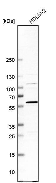 ADHFE1 Antibody - BSA Free Western Blot: ADHFE1 Antibody - BSA Free [NBP1-83530]
