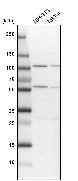ADHFE1 Antibody - BSA Free Western Blot: ADHFE1 Antibody - BSA Free [NBP1-83530]