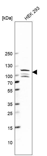 ANKS3 Antibody - BSA Free Western Blot: ANKS3 Antibody - BSA Free [NBP1-83531]