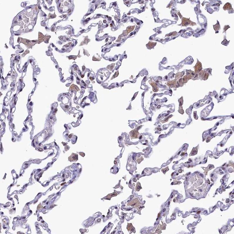 ANKS3 Antibody - BSA Free Immunohistochemistry-Paraffin: ANKS3 Antibody - BSA Free [NBP1-83531]