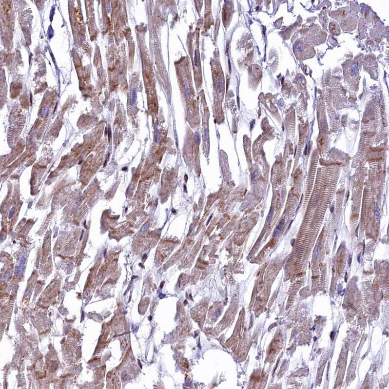 ANKS3 Antibody - BSA Free Immunohistochemistry-Paraffin: ANKS3 Antibody - BSA Free [NBP1-83531]