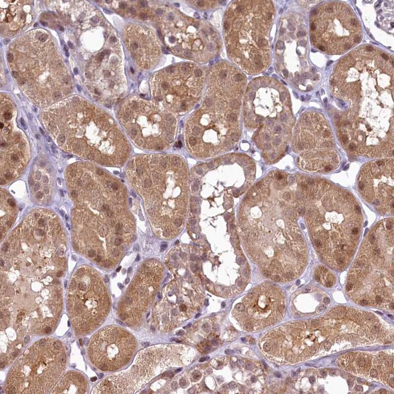 ANKS3 Antibody - BSA Free Immunohistochemistry-Paraffin: ANKS3 Antibody - BSA Free [NBP1-83531]