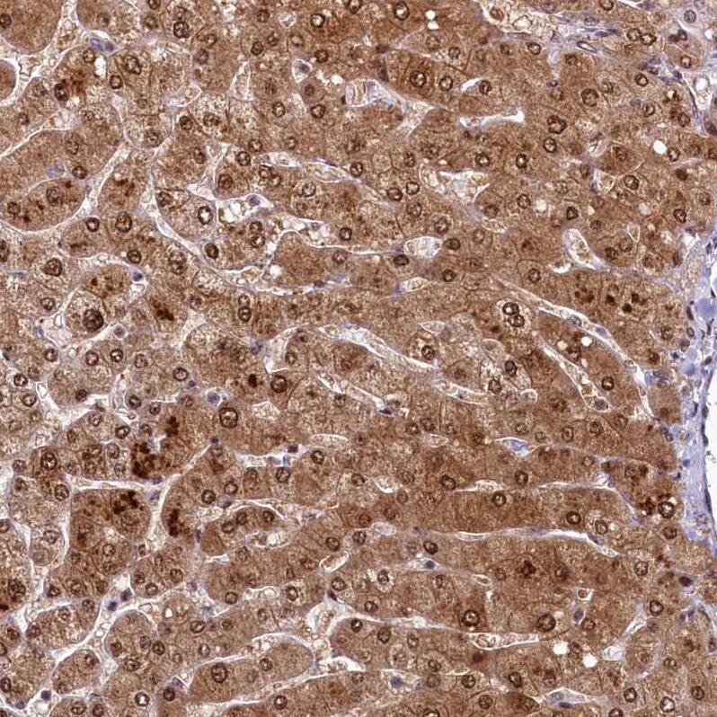 ANKS3 Antibody - BSA Free Immunohistochemistry-Paraffin: ANKS3 Antibody - BSA Free [NBP1-83531]