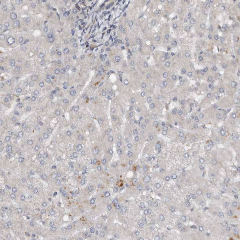 CCDC43 Antibody - BSA Free Immunohistochemistry-Paraffin: CCDC43 Antibody - BSA Free [NBP1-83536]