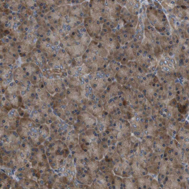 TMEM74 Antibody - BSA Free Immunohistochemistry-Paraffin: TMEM74 Antibody [NBP1-83546]