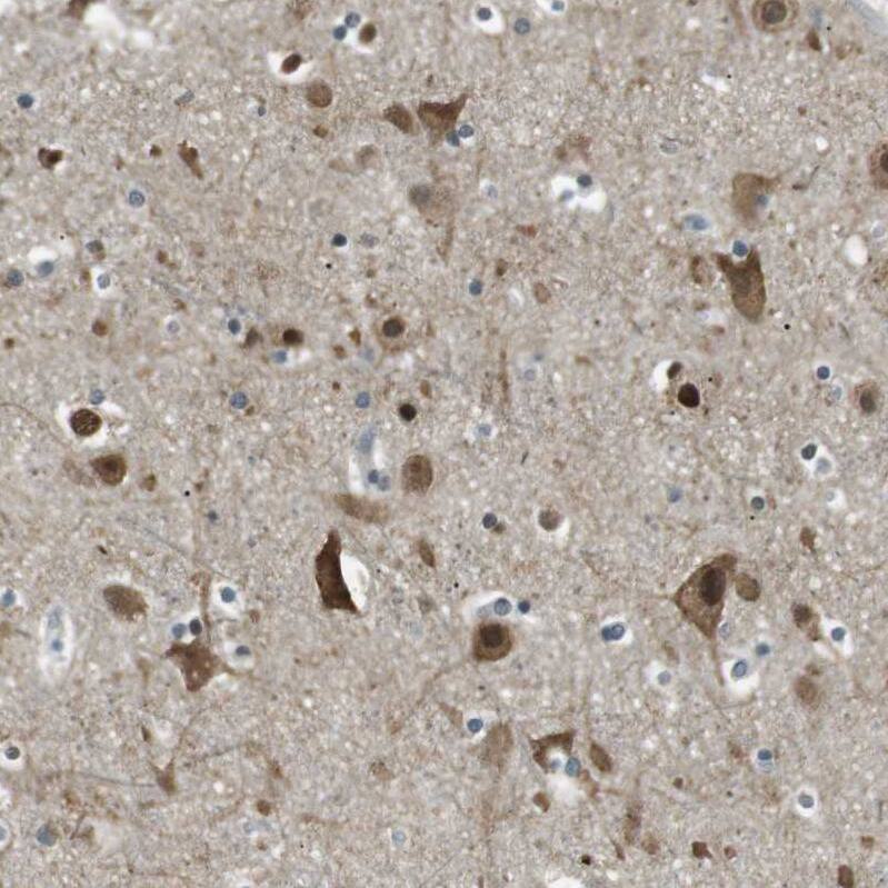 TMEM74 Antibody - BSA Free Immunohistochemistry-Paraffin: TMEM74 Antibody [NBP1-83546]