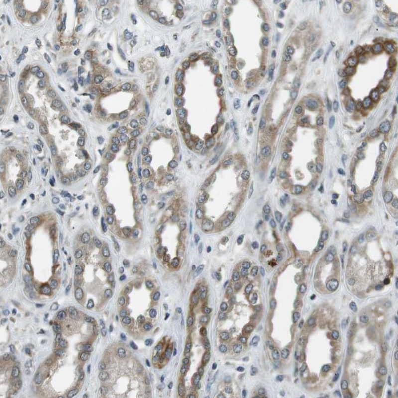 TMEM74 Antibody - BSA Free Immunohistochemistry-Paraffin: TMEM74 Antibody [NBP1-83546]