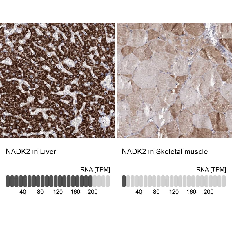 NADKD1 Antibody - BSA Free Immunohistochemistry-Paraffin: NADKD1 Antibody [NBP1-83547]