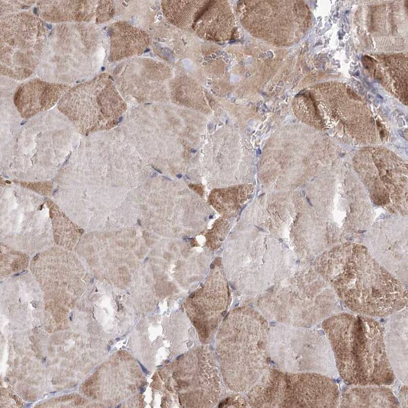 NADKD1 Antibody - BSA Free Immunohistochemistry-Paraffin: NADKD1 Antibody [NBP1-83547]
