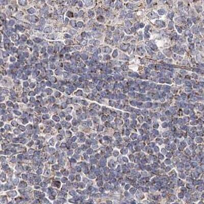 NADKD1 Antibody - BSA Free Immunohistochemistry-Paraffin: NADKD1 Antibody [NBP1-83547]