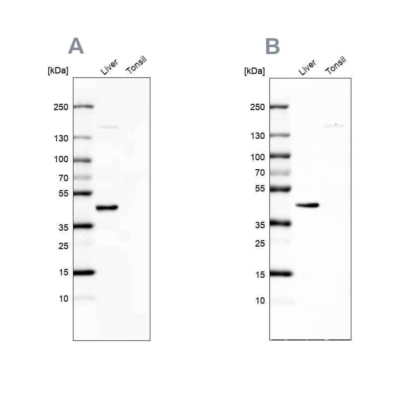 NADKD1 Antibody - BSA Free Western Blot: NADKD1 Antibody - BSA Free [NBP1-83547]