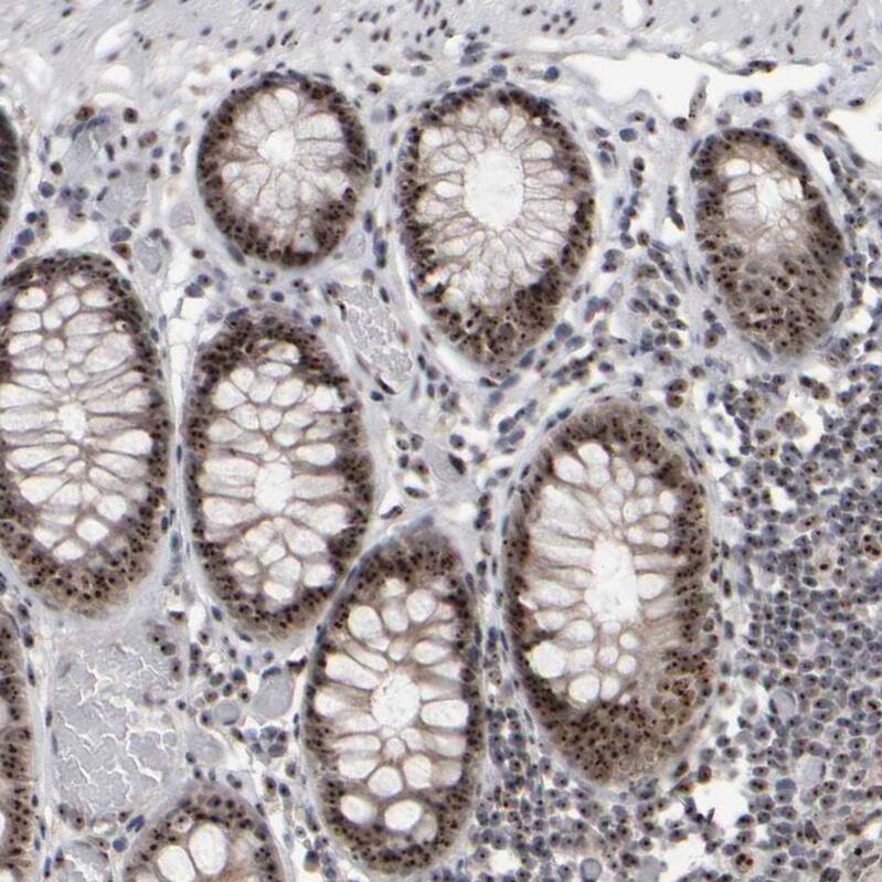 Surf6 Antibody - BSA Free Immunohistochemistry-Paraffin: Surf6 Antibody - BSA Free [NBP1-83550]