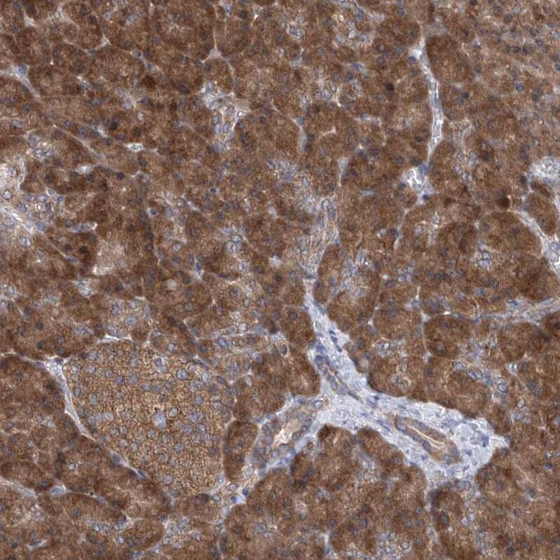 EIF3M Antibody - BSA Free Immunohistochemistry-Paraffin: EIF3M Antibody - BSA Free [NBP1-83552]