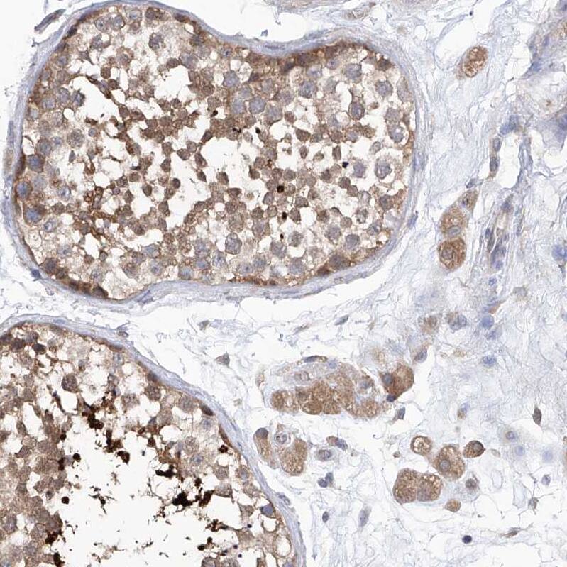 EIF3M Antibody - BSA Free Immunohistochemistry-Paraffin: EIF3M Antibody - BSA Free [NBP1-83552]