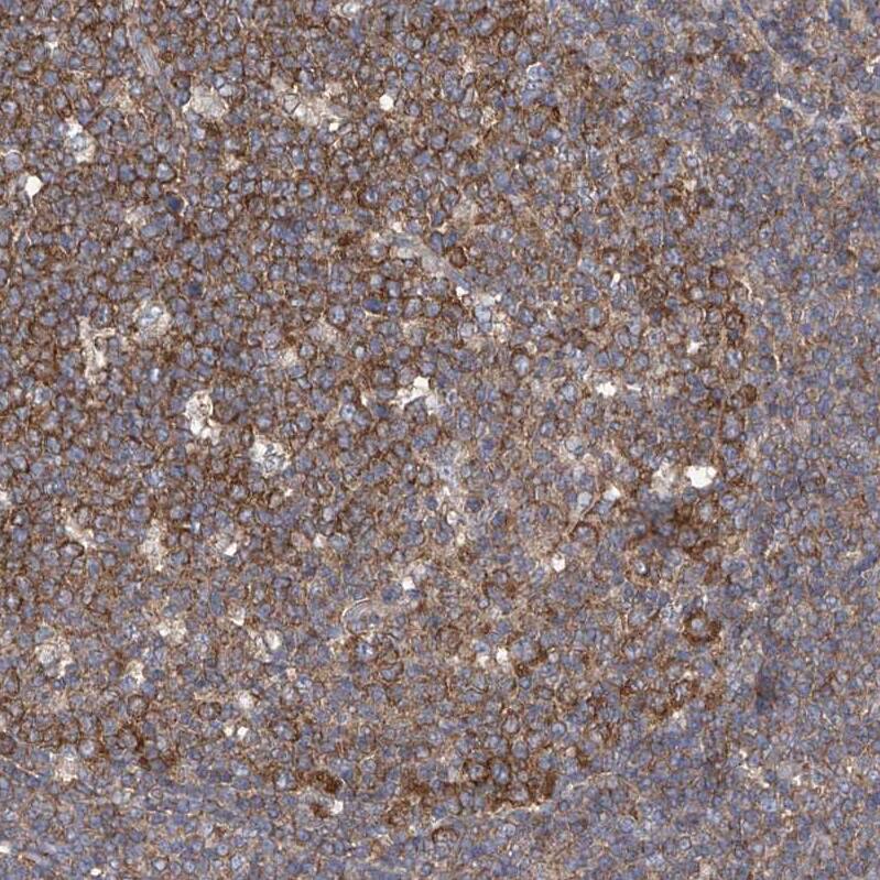 EIF3M Antibody - BSA Free Immunohistochemistry-Paraffin: EIF3M Antibody - BSA Free [NBP1-83552]