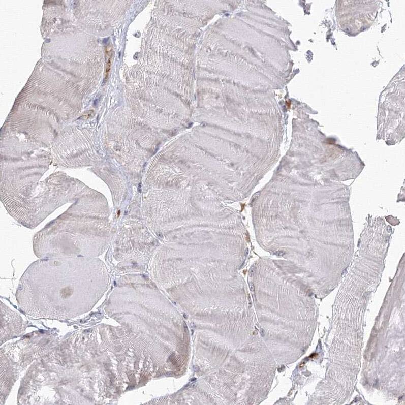 GRPEL1 Antibody - BSA Free Immunohistochemistry-Paraffin: GRPEL1 Antibody - BSA Free [NBP1-83557]
